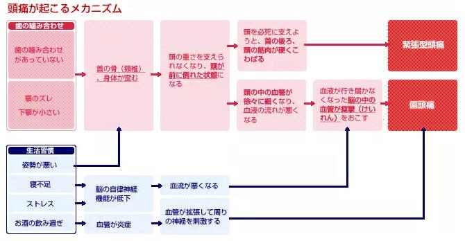 在日本如何诊断和治疗慢性头痛 厚朴方舟
