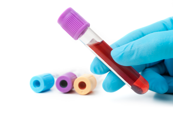 丹娜-法伯新研究：一种新开发的血液测试可对多种癌症进行筛查