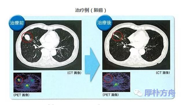 <a href='/japan/'>日本看病</a>