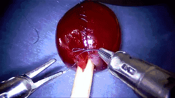 <a  data-cke-saved-href='/' href='/'>出国看病</a>