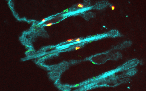 <a href='/'>出国看病</a>