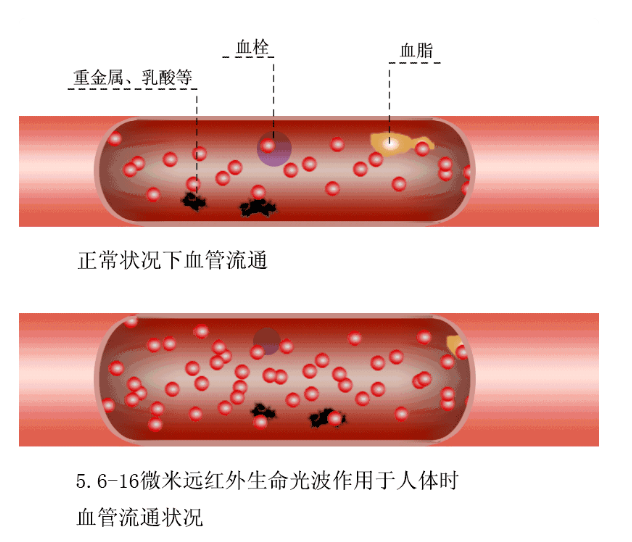日本预防心脏病