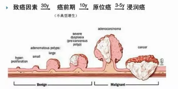 日本治疗结直肠癌