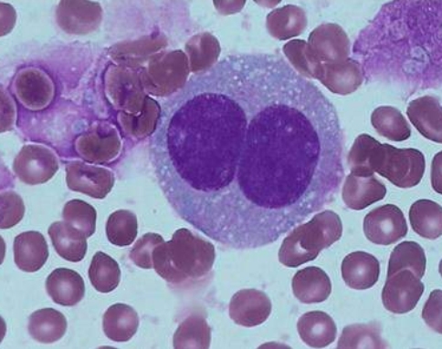 美国治疗淋巴瘤