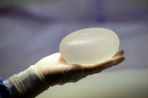 乳房假体可能引发淋巴瘤