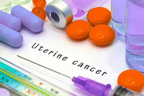 宫颈癌发病原因