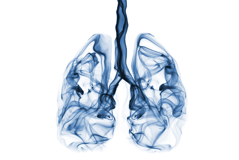 囊性纤维病,出国看病