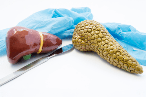 胰腺神经内分泌肿瘤是什么?应该如何治疗胰腺神经内分泌肿瘤?