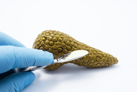 研究揭示调节性T细胞在胰腺癌中的作用,胰腺癌新治疗方法指日可待!