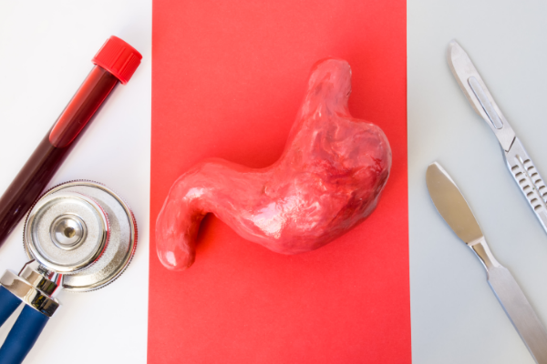 日本胃癌五年生存率为什么这么逆天? 日本胃癌五年生存率居高不下的原因