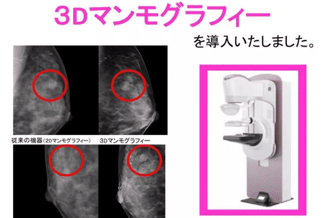 重离子治疗