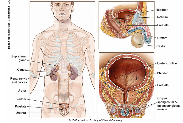 美国前列腺癌靶向药