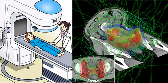 日本宫颈癌治疗医院 日本宫颈癌治疗医院