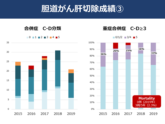 日本癌研有明医院治疗胆管癌 日本癌研有明医院治疗胆管癌