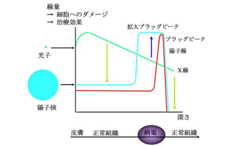 质子治疗