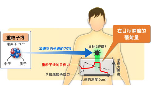 日本重离子治疗中心