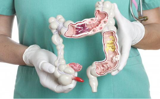 结肠癌直肠癌手术治疗 结肠癌直肠癌手术治疗