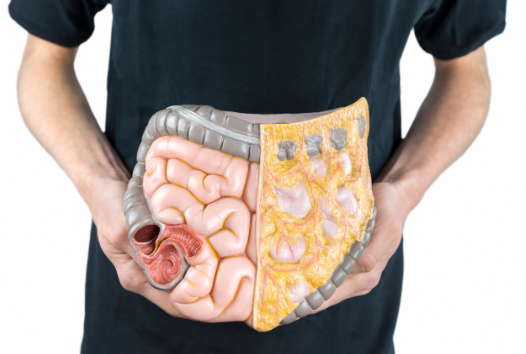 美国结直肠癌治疗 美国结直肠癌治疗